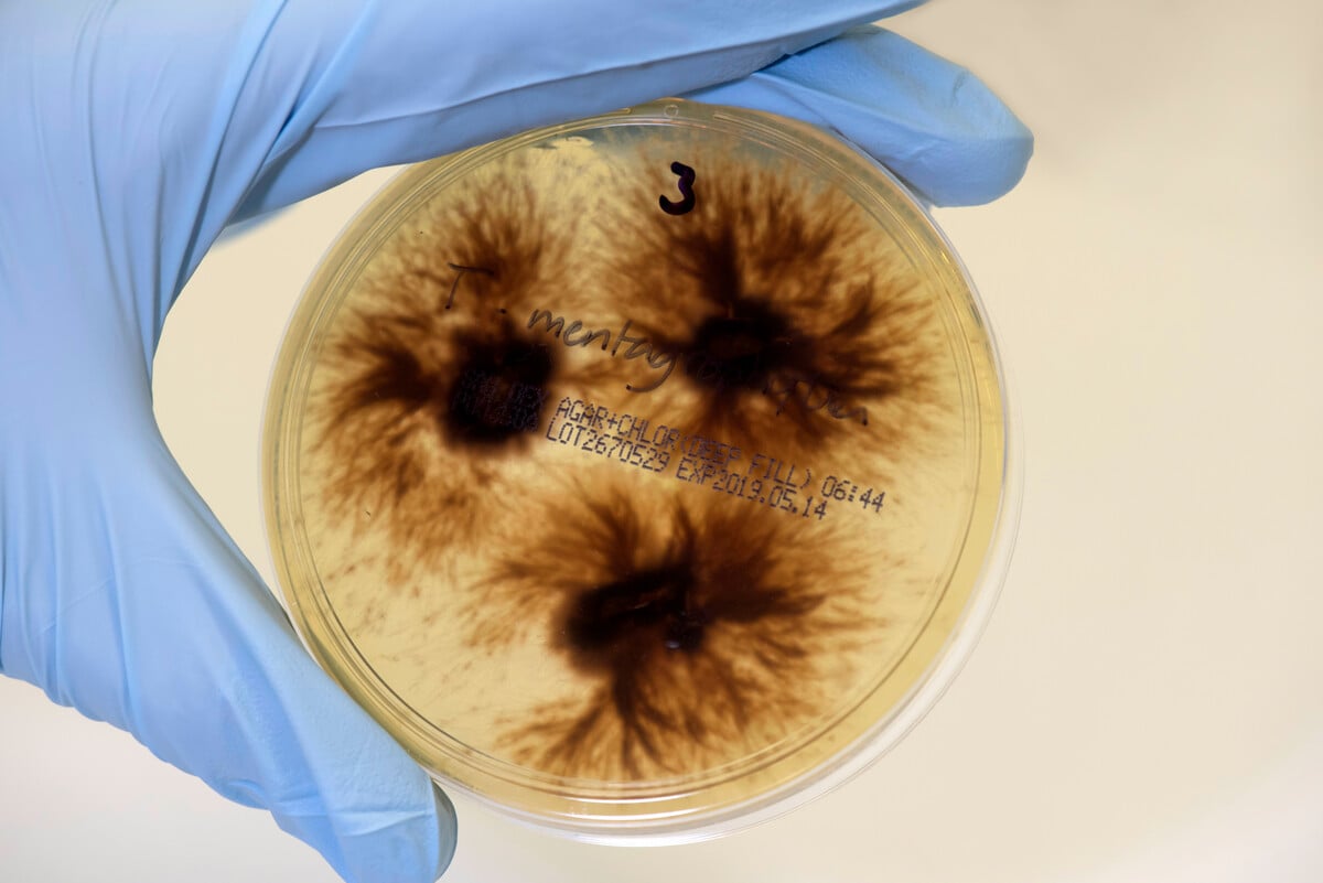 The growing threat of fungal infection and antifungal resistance LSHTM
